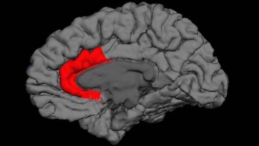 Scan av en hjerne med et område farget rødt.